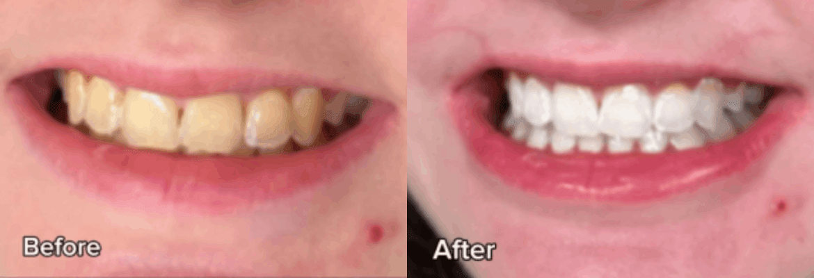 BrowQueen Microblading & Permanent Makeup 